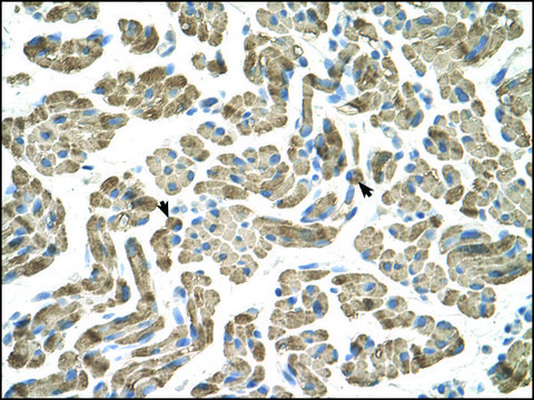 Anti-NEU1 IgG fraction of antiserum