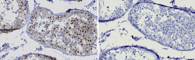 Anti-UBE3A Antibody, clone 1B9 ZooMAb&#174; Rabbit Monoclonal recombinant, expressed in HEK 293 cells