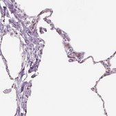 Anti-TMEM100 antibody produced in rabbit Prestige Antibodies® Powered by Atlas Antibodies, affinity isolated antibody, buffered aqueous glycerol solution
