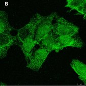 Anti-ULBP-3 Antibody, clone 3C10 ZooMAb® Rabbit Monoclonal recombinant, expressed in HEK 293 cells