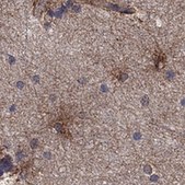 Anti-NTRK2 antibody produced in rabbit Prestige Antibodies® Powered by Atlas Antibodies, affinity isolated antibody, buffered aqueous glycerol solution