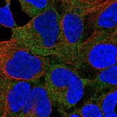 Anti-CAMK1 antibody produced in rabbit Prestige Antibodies® Powered by Atlas Antibodies, affinity isolated antibody, buffered aqueous glycerol solution