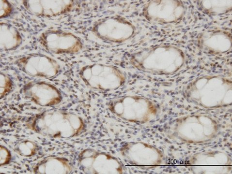 Monoclonal Anti-CSE1L, (C-terminal) antibody produced in mouse clone 2C10, purified immunoglobulin, buffered aqueous solution