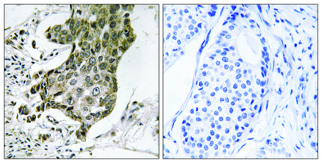 Anti-RABEP1 antibody produced in rabbit affinity isolated antibody