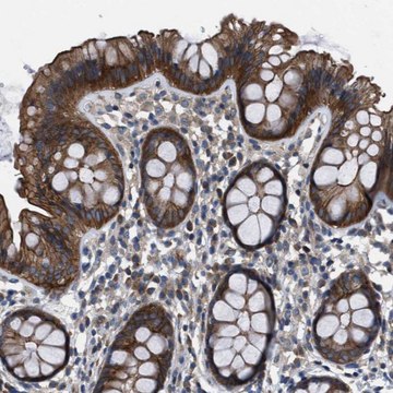 Anti-TRIP4 antibody produced in rabbit Prestige Antibodies&#174; Powered by Atlas Antibodies, affinity isolated antibody, buffered aqueous glycerol solution