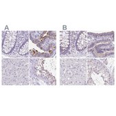 Anti-ANKRD45 antibody produced in rabbit Prestige Antibodies® Powered by Atlas Antibodies, affinity isolated antibody, buffered aqueous glycerol solution, ab2
