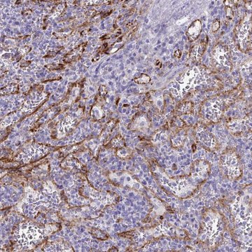 Anti-KRIT1 antibody produced in rabbit Prestige Antibodies&#174; Powered by Atlas Antibodies, affinity isolated antibody, buffered aqueous glycerol solution