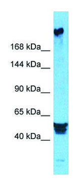 Anti-PREX2 (N-terminal) antibody produced in rabbit affinity isolated antibody