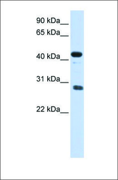 Anti-CDCA5 antibody produced in rabbit affinity isolated antibody