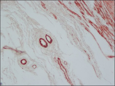 Anti-Mouse IgG (Fab specific)–Peroxidase antibody produced in goat affinity isolated antibody, buffered aqueous solution