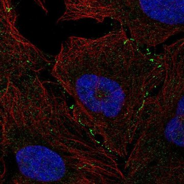 Anti-VCAM1 antibody produced in rabbit Prestige Antibodies&#174; Powered by Atlas Antibodies, affinity isolated antibody