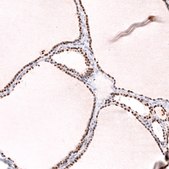 Monoclonal Anti-Nkx2-1 Antibody Produced In Mouse Prestige Antibodies® Powered by Atlas Antibodies, clone CL14531, affinity isolated antibody, buffered aqueous glycerol solution