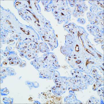 Factor VIII-R Ag. Rabbit Polyclonal Antibody