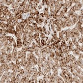 Anti-ACOX1 antibody produced in rabbit Prestige Antibodies® Powered by Atlas Antibodies, affinity isolated antibody, buffered aqueous glycerol solution