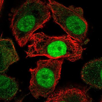 Anti-JMJD6 antibody produced in rabbit Prestige Antibodies&#174; Powered by Atlas Antibodies, affinity isolated antibody