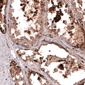 Anti-NAPSA antibody produced in mouse Prestige Antibodies® Powered by Atlas Antibodies, clone CL12954, purified by using Protein A, buffered aqueous glycerol solution