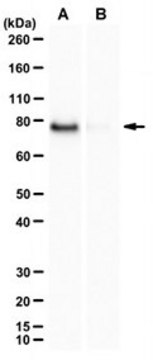 Anti-Prelamin-A Antibody, clone 3C8