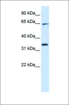 Anti-RHOT1 (ab1) antibody produced in rabbit affinity isolated antibody