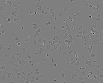 MCF7 Cell Line human NOTE: Both the cell line and DNA from the cell line may be available for this product. Please choose -1VL or VIAL for cells, or -DNA-5UG for DNA, 86012803, human breast (adenocarcinoma), Epithelial-like