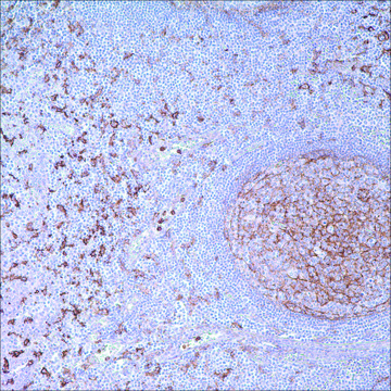 CD14 (EPR3653) Rabbit Monoclonal Primary Antibody