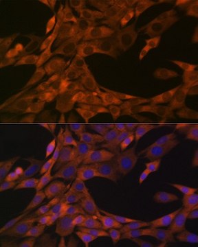 Anti-HE4/WFDC2 antibody produced in rabbit