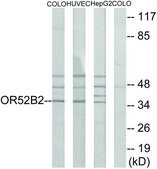 Anti-OR52B2 antibody produced in rabbit affinity isolated antibody