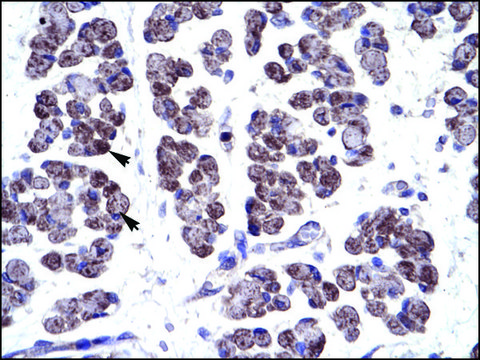 抗-TBX20 (AB1) 兔抗 affinity isolated antibody