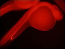 Anti-NOLC1 antibody produced in rabbit IgG fraction of antiserum