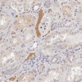 Anti-CFI antibody produced in rabbit Prestige Antibodies® Powered by Atlas Antibodies, affinity isolated antibody, buffered aqueous glycerol solution