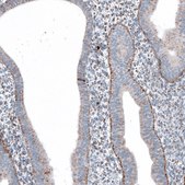 Anti-ME3 antibody produced in rabbit Prestige Antibodies® Powered by Atlas Antibodies, affinity isolated antibody, buffered aqueous glycerol solution