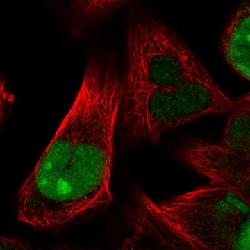 Anti-HJURP antibody produced in rabbit Prestige Antibodies&#174; Powered by Atlas Antibodies, affinity isolated antibody