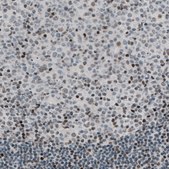 Monoclonal Anti-TLE3 antibody produced in mouse Prestige Antibodies® Powered by Atlas Antibodies, clone CL3573, purified immunoglobulin, buffered aqueous glycerol solution