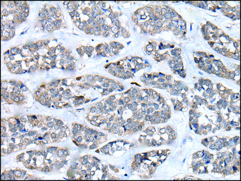 抗-CD274 affinity isolated antibody