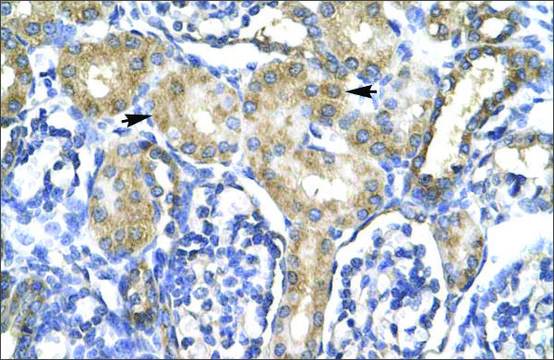 Anti-ACSL1 (AB1) antibody produced in rabbit affinity isolated antibody