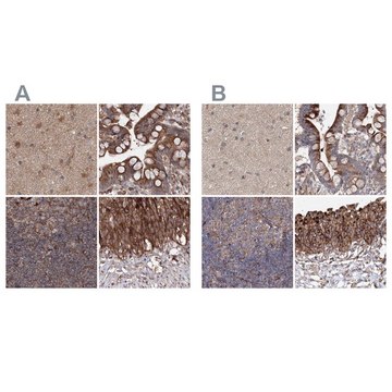 Anti-DDO antibody produced in rabbit Prestige Antibodies&#174; Powered by Atlas Antibodies, affinity isolated antibody, buffered aqueous glycerol solution