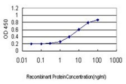 Monoclonal Anti-SMC6L1 antibody produced in mouse clone 2E6, purified immunoglobulin, buffered aqueous solution