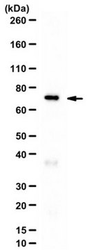 Anti-iPLA2 Antibody from rabbit, purified by affinity chromatography