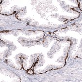 Monoclonal Anti-Smarcb1 Antibody Produced In Mouse Prestige Antibodies® Powered by Atlas Antibodies, clone CL14017, affinity isolated antibody, buffered aqueous glycerol solution