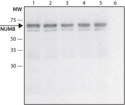 Anti-NUMB (C-terminal) antibody produced in rabbit ~1.0&#160;mg/mL, affinity isolated antibody