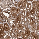 Anti-TRMT61B antibody produced in rabbit Prestige Antibodies® Powered by Atlas Antibodies, affinity isolated antibody, buffered aqueous glycerol solution, Ab2