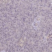 Anti-RIOK1 antibody produced in rabbit Prestige Antibodies® Powered by Atlas Antibodies, affinity isolated antibody, buffered aqueous glycerol solution