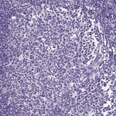 Anti-KRTAP20-3 antibody produced in rabbit Prestige Antibodies® Powered by Atlas Antibodies, affinity isolated antibody, buffered aqueous glycerol solution