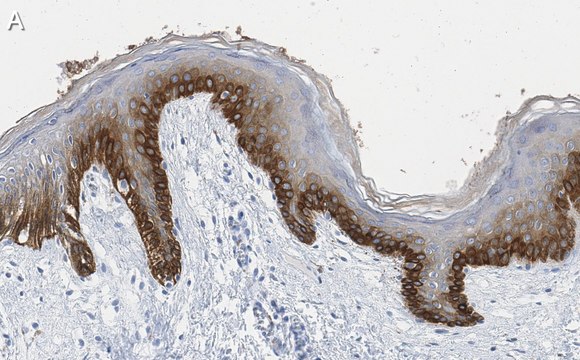 Anti-pan-cytokeratin Antibody, clone AE1 ZooMAb&#174; Mouse Monoclonal recombinant, expressed in HEK 293 cells