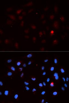 Anti-Phospho-CDK1-T14 antibody produced in rabbit