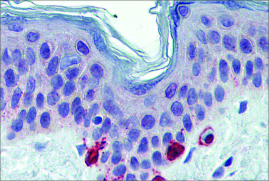 Anti-TYRP1 antibody produced in rabbit affinity isolated antibody