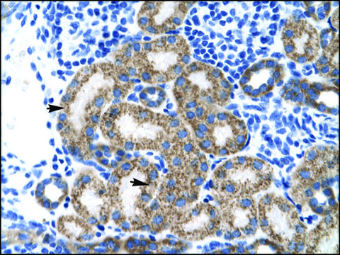 Anti-TBPL1 antibody produced in rabbit IgG fraction of antiserum