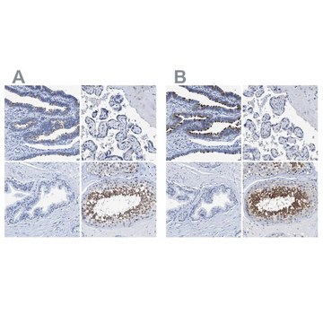 Anti-DNAI1 antibody produced in rabbit Prestige Antibodies&#174; Powered by Atlas Antibodies, affinity isolated antibody, buffered aqueous glycerol solution, Ab2