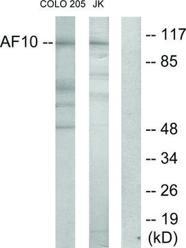 Anti-AF10 antibody produced in rabbit affinity isolated antibody