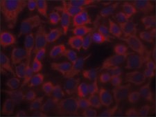 Anti-Actin (α-Sarcomeric) antibody, Mouse monoclonal clone 5C5, hybridoma cell culture supernatant