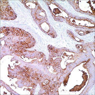 BG8, LewisY (F3) Mouse Monoclonal Antibody